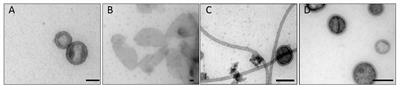 In vitro Analysis of O-Antigen-Specific Bacteriophage P22 Inactivation by Salmonella Outer Membrane Vesicles